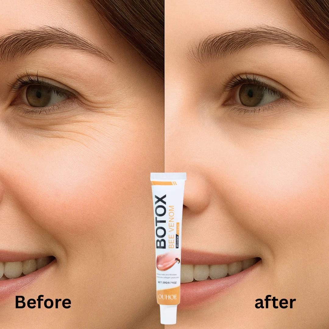 Botox Bee Venom Wrinkle Removal Cream.